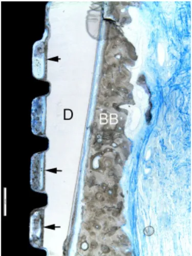 Figure 1 : Vue détaillée de l’implant au contact de la dentine (D) montrant la présence du ligament  physiologique et l’os cortical (BB)