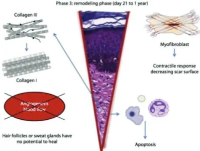 Figure 4 : La phase de remodelage (7). 