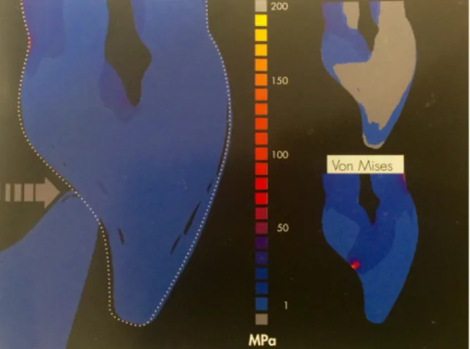 Figure   20:   Contraintes   sur   la   face   palatine   en   position   d’OIM   (29)       