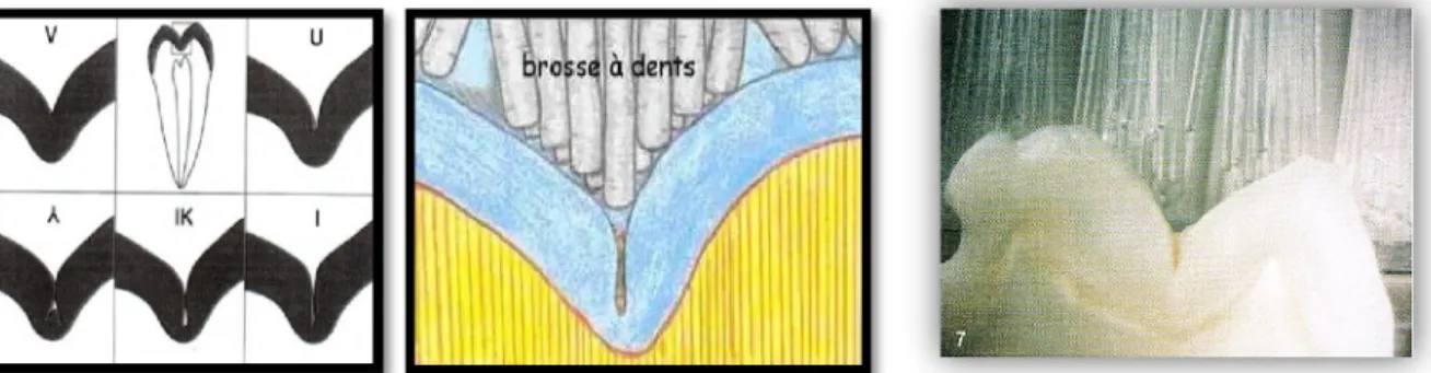 Figure 2 : Différentes formes de puits et fissures. Sources : figures 2.1 (6), 2.2  1 , 2.3 (10) 