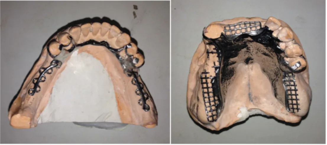 Figure 29: Rapports maxillo­mandibulaires confirmant l'importance de la classe III 