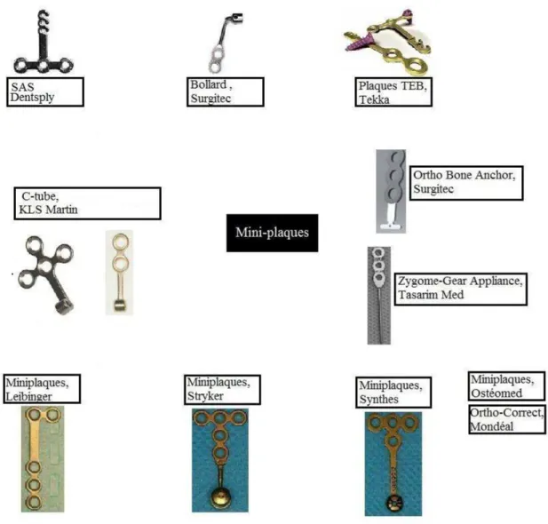 Figure 15 : Les différents types de miniplaques (schéma personnel) 