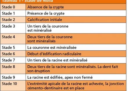 Figure 2 : Tableau des différents stades de la dent décrite par Nolla 