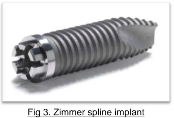 Fig 3. Zimmer spline implant 