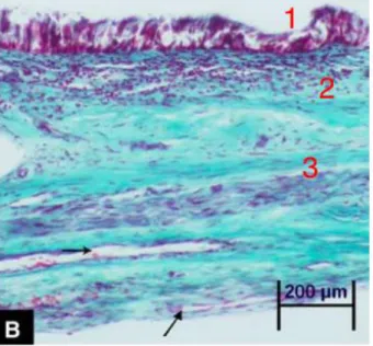 Figure 17 : Section histologique de la membrane de Schneider (23) 
