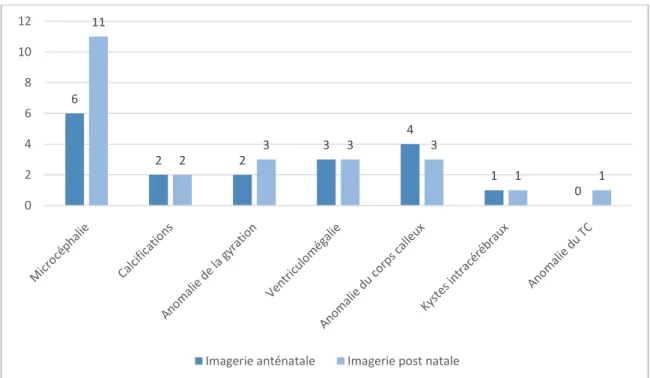 Figure 4 : Différents types de malformations cérébrales diagnostiquées en anténatal  et postnatal