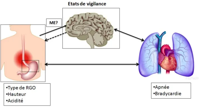 Figure  4.  Interactions  entre  les  reflux,  le  niveau  d’activité  cérébrale  et  la  sphère  cardiorespiratoire