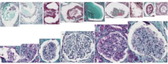 Fig. 2. Example of candidate glomeruli detected by step 1.