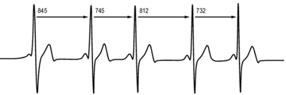 Figure 6 : Variabilité de la fréquence cardiaque entre chaque battement du cœur. 