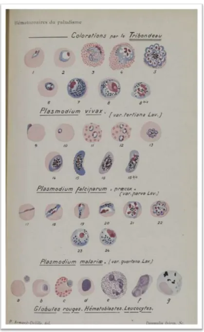 Figure 19 : Coloration des différents plasmodium par la méthode de  Tribondeau (Armand-Delille P