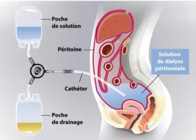 Figure 7 : Le fonctionnement de la DP (104) 
