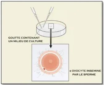 Figure 5 : Déroulement de la FIV classique. (FIV.fr) 
