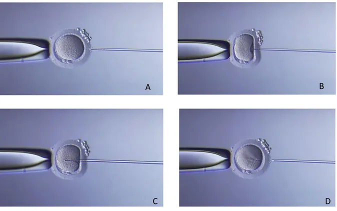 Figure 6 : Injection d’un spermatozoïde dans un ovocyte sous contrôle microscopique lors  de FIV ICSI et FIV IMSI