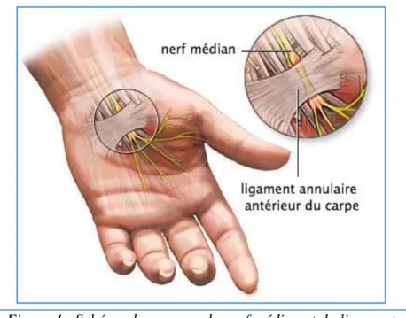 Figure 4 : Schéma du passage du nerf médian et du ligament  annulaire antérieur du carpe