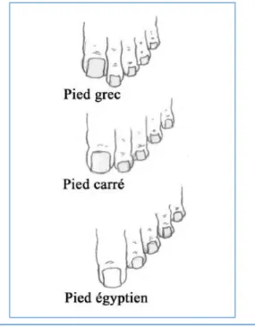 Figure 13 : Schéma des différents types de pied 