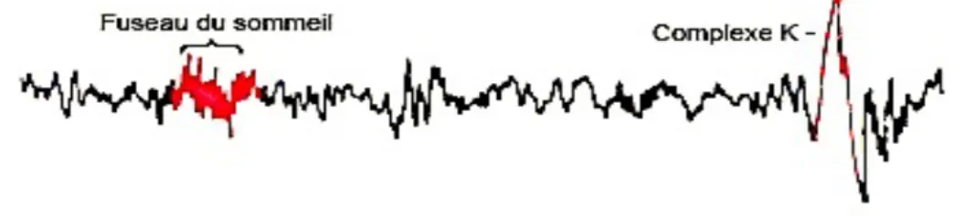 Figure 2 Tracé d'un fuseau de sommeil et d'un complexe K 