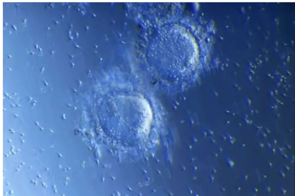 Figure 10 : Ovocytes inséminés par des spermatozoïdes  (https://www.fiv.fr/fiv-classique/) 