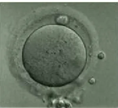 Figure 11 : Ovocyte au stade métaphase II 