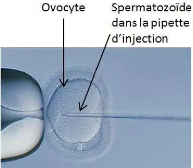 Figure 12 : Injection directe du spermatozoïde dans l’ovocyte par la technique  d’injection intra-cytoplasmique (ICSI) 