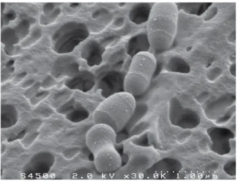 Figure   8   :   Bactérie   intestinale   dégradant   le   cholestérol   vue   par   microscope   électronique