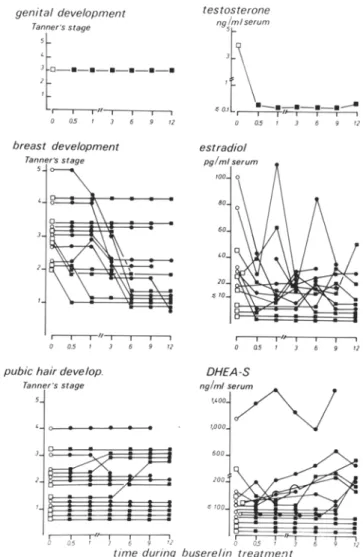 Fig. 2. Individual values of genital, breast  and pubic hair development  evaluated  according  to  Tanner  and  testosterone,  oestradiol  and  D H E A S   serum concentrations  before and  during  1 year of intranasal  Buserelin  administration  in  pati