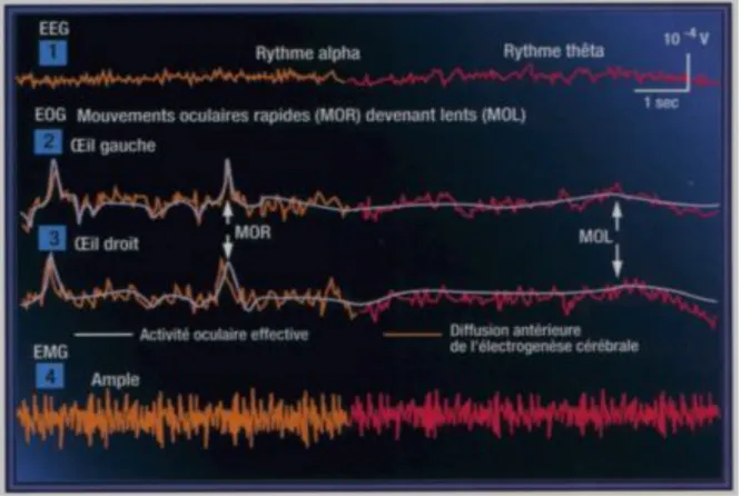 Figure 2 : Présentation de l’EEG, l’EOG et l’EMG du stade 1 (128)