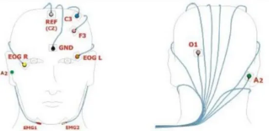 Figure 11 : Positionnement des électrodes pour une polysomnographie (21) 