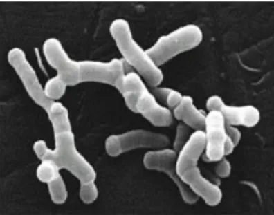 Figure 3 - Photographie au microscope électronique de bactéries du genre Bifidobacterium  15 