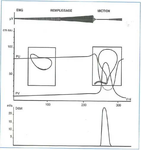 Figure 10 : « Modifications morphologiques et évolution de la pression endovésicale, endo- endo-urétrale et de l’activité électrique du sphincter strié au cours du remplissage de la vessie