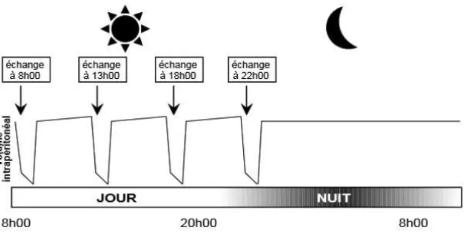 Figure 6 : Exemple d'une stratégie de DPCA (source HAS, 2007) 