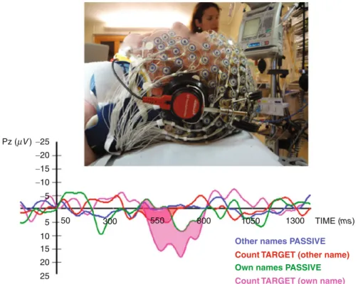 Fig. 8 “ Active ” event-related potentials showing command following ( “ count a name ” ) and hence total locked-in syndrome