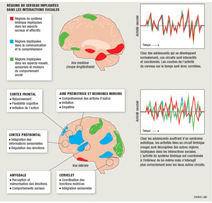 Figure 5  : Activité du cerveau et autisme 