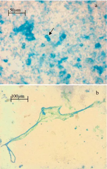 Fig. 2. Microscopic view of material sampled from a meso- meso-cosm on 0.4 µm membrane filter and stained with the  poly-saccharide-specific dye Alcian Blue