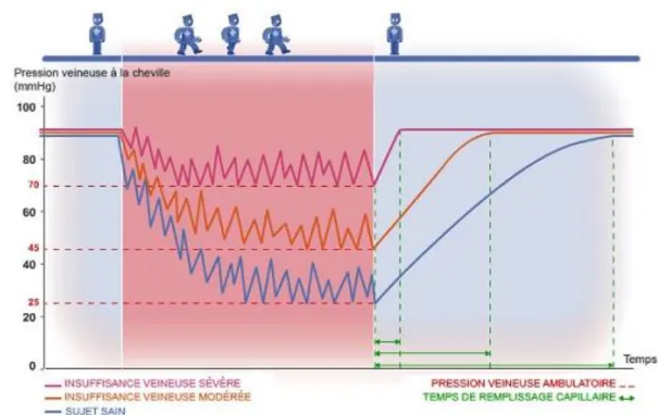 Figure 15 : Variation de la pression veineuse à la marche (31) 