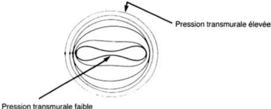 Figure 8 : Variation de l’aspect de la veine en fonction de la pression transmurale 