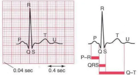 Figure 8 : Tracé d'un électrocardiogramme normal en dérivation D2. (Adapté de [10]) 