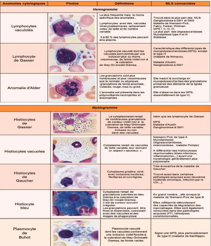 Figure 5 : Principales anomalies cytologiques rencontrées dans les MLS. adaptée daprès Maier- Maier-redelsperger et Fenneteau  49