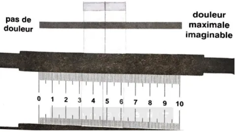 Figure 12 - Exemple d'EVA (28) 