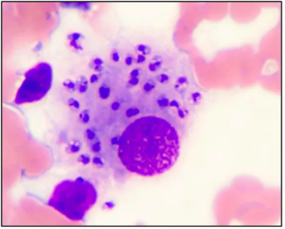 Figure 2 : Amastigotes de Leishmania infantum dans un macrophage  Dr. Gad Baneth