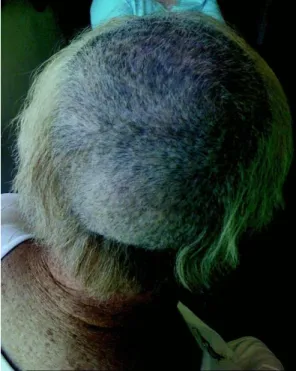 Fig. 22 :  Fig. 23 : 