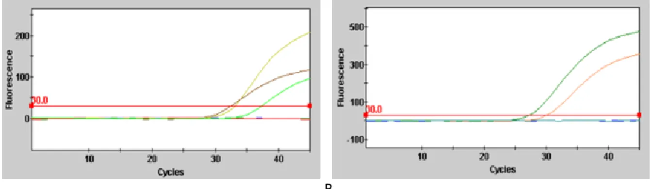 Figure 9 : Courbes d’amplification des différents sérums disponibles au laboratoire. 