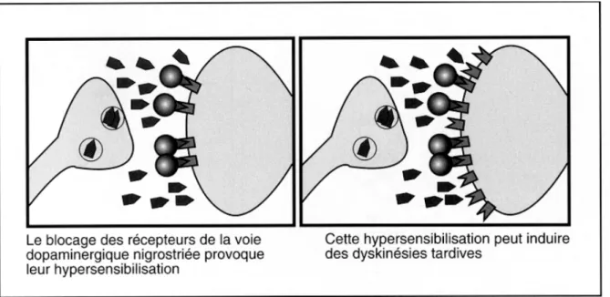 Figure 5 : Blocage à long terme des R-D 2  (26)