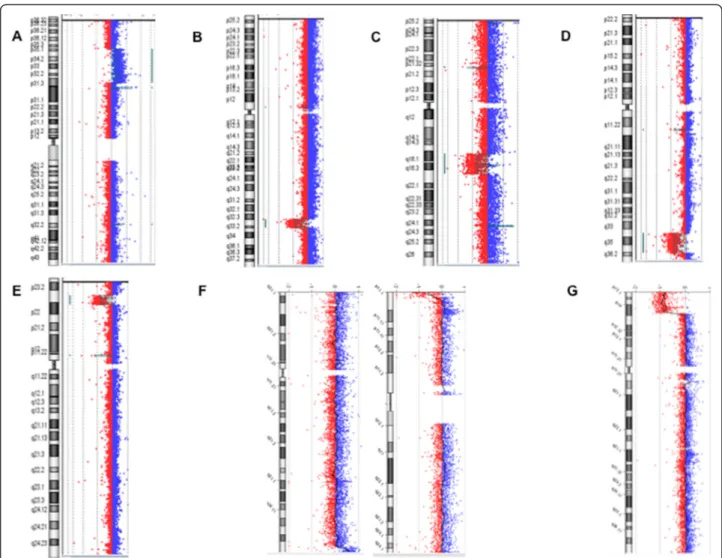 Figure 2 Results of array-CGH analysis. A large duplication 1p35.3p31.3 found in patient 16; B chromosome 2q33.1q33.3 deletion found in patient 20