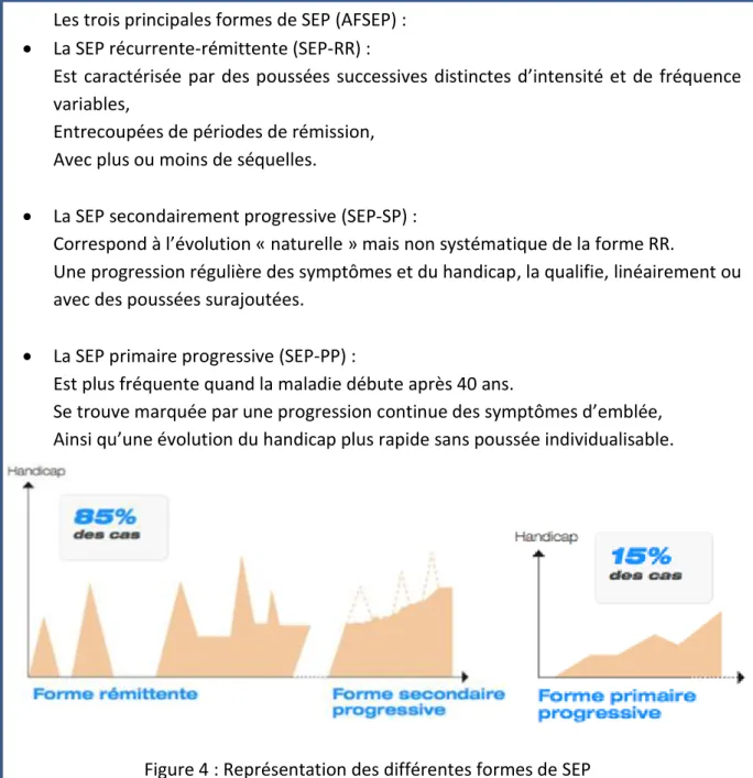 Figure 4 : Représentation des différentes formes de SEP 