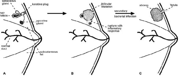 Figure 2 : Modèle de Berna-Serna et Berna-Mestre pour la physiopathologie de la Mamillary fistula