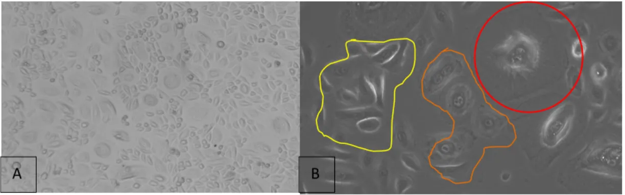 Figure  12 :  Photo  de  kératinocytes  prises  dans  une  flasque  après  deux  passages,  observés  au  microscope  optique  inversé et grossi 100 fois(A) ou 200 fois (B)