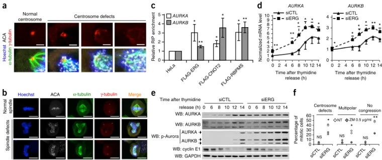Figure 6  siERG-induced mitotic defects are due to overactivation of Aurora signaling