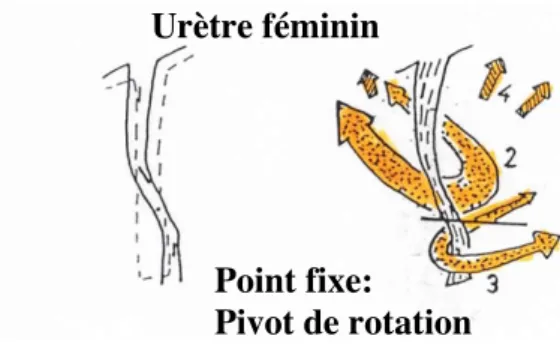 Figure  3:  Le  «point  fixe»  de  Jean  de  Leval. Le  «point  fixe»  sépare  deux segments urétraux distincts, l’un inférieur et l’autre supérieur