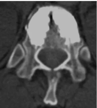Figure 5 : Radiographie de profil post-opératoire.