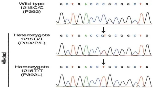 Figure 13. Chromatogrammes de la découverte de la première mutation germinale associée avec la MOP